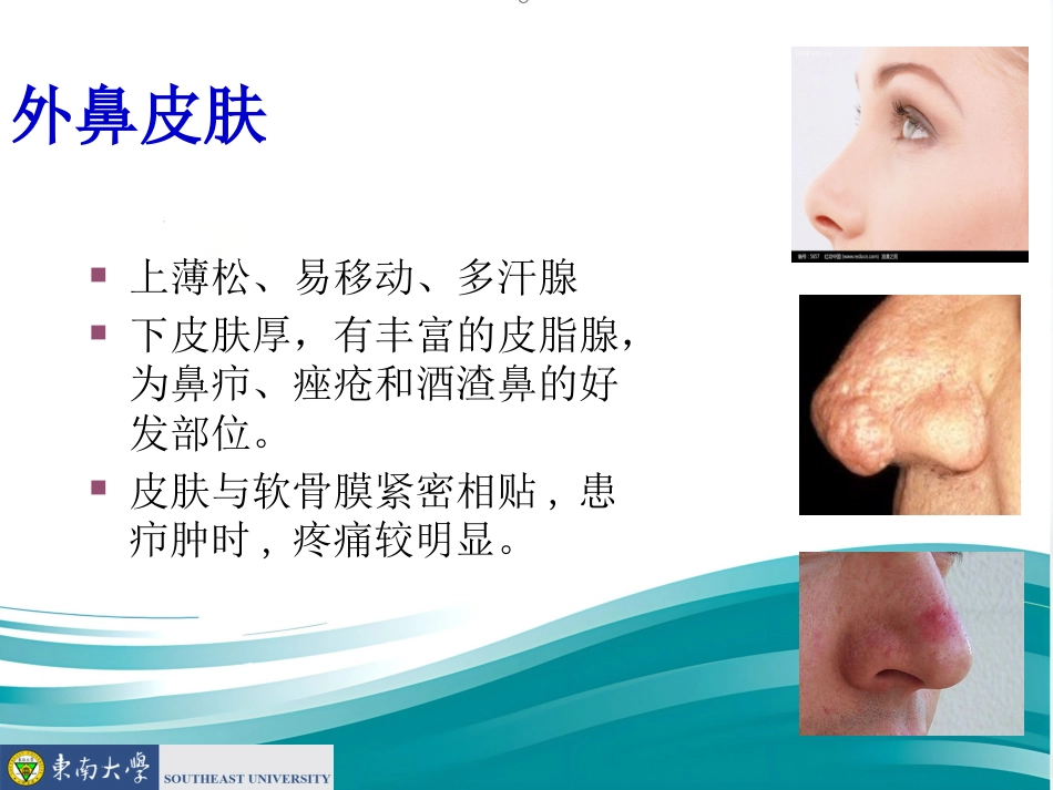 鼻的应用解剖及生理PPT课件_第4页