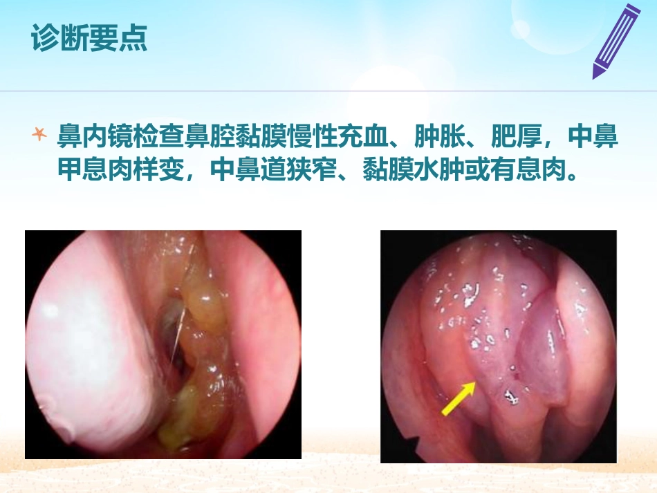 鼻窦炎患者的_第12页