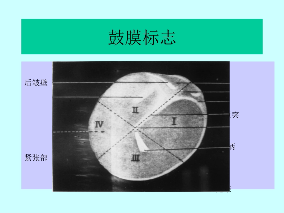 耳鼻喉科解剖_第12页