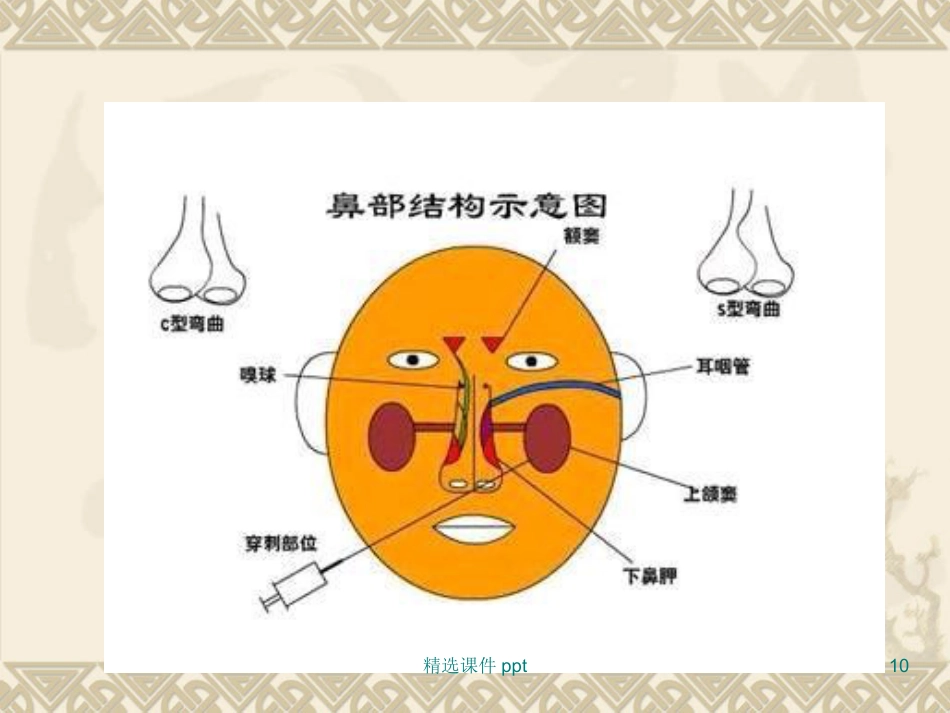 鼻炎鼻窦炎_第10页