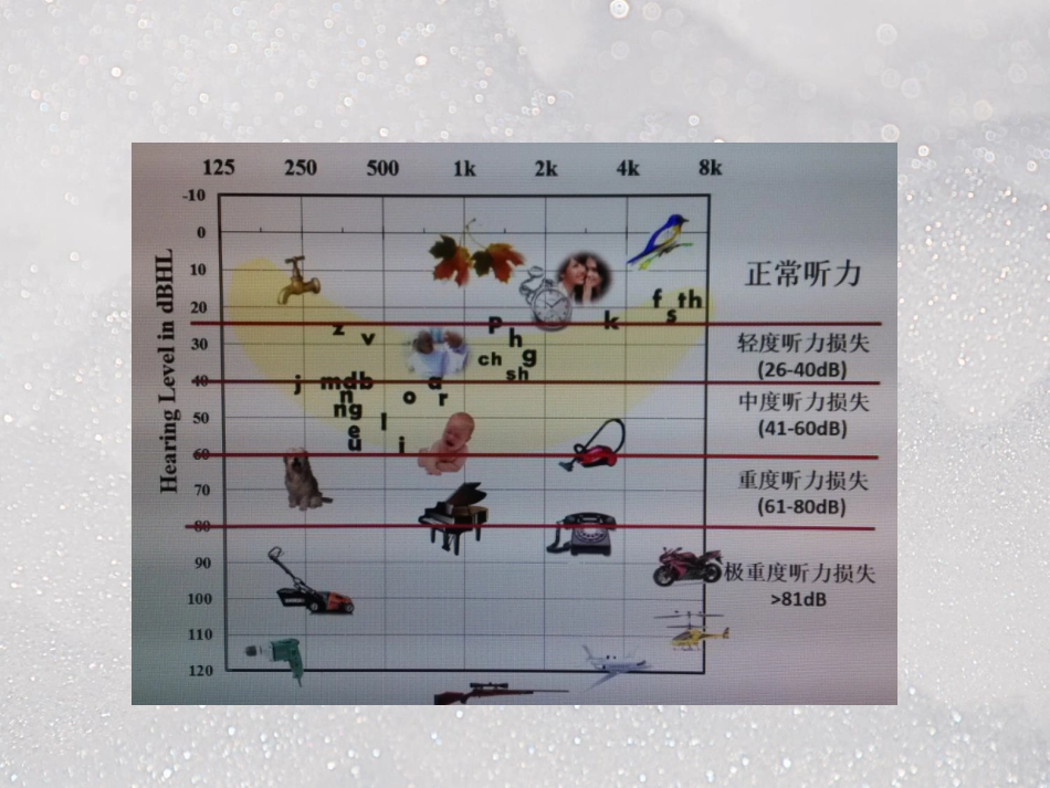 常见耳源性眩晕ppt课件_第6页