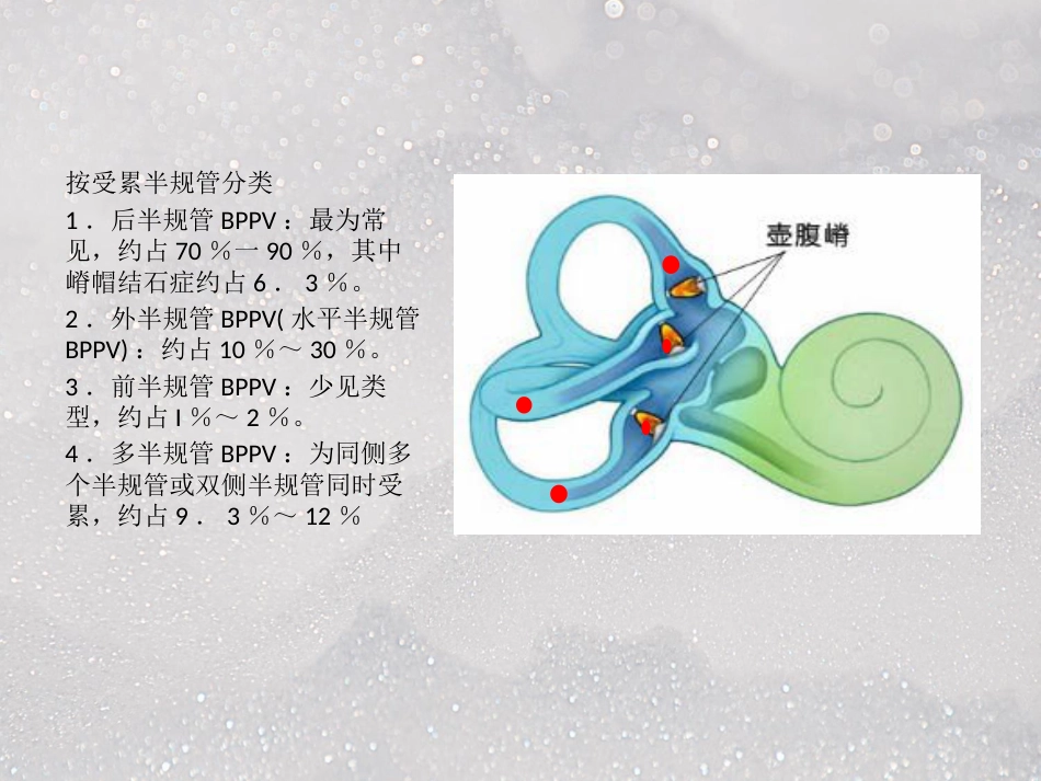 常见耳源性眩晕ppt课件_第8页