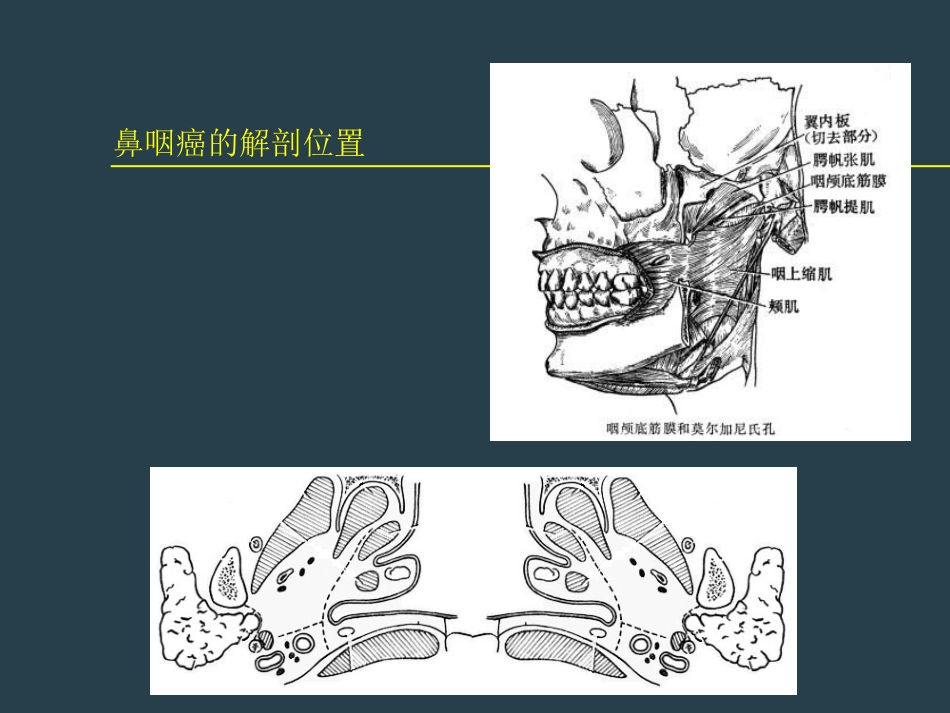 鼻咽癌放射治疗ppt_第8页
