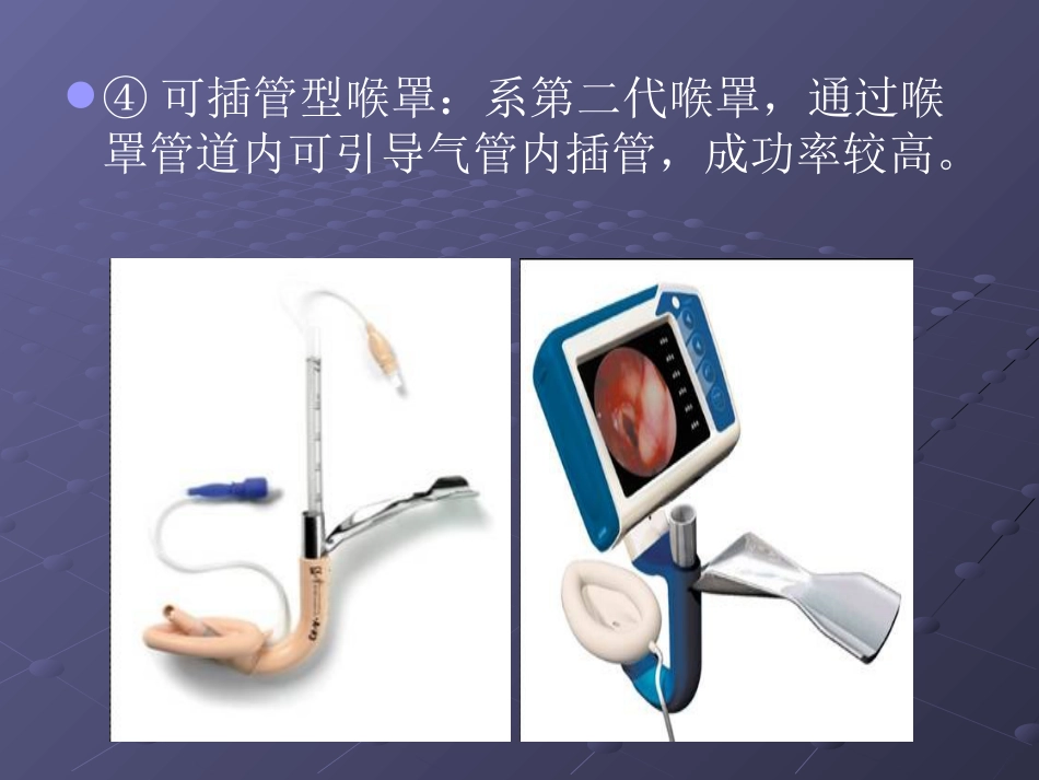 喉罩的临床使用_第14页