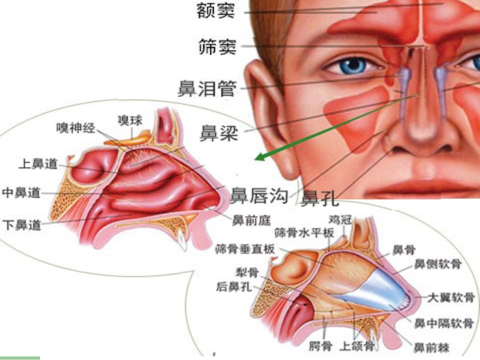 鼻息肉_第2页