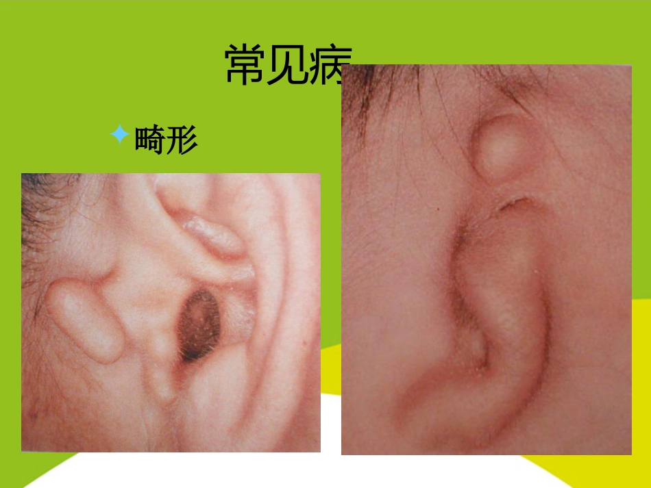 耳的应用解剖与生理PPT_第7页