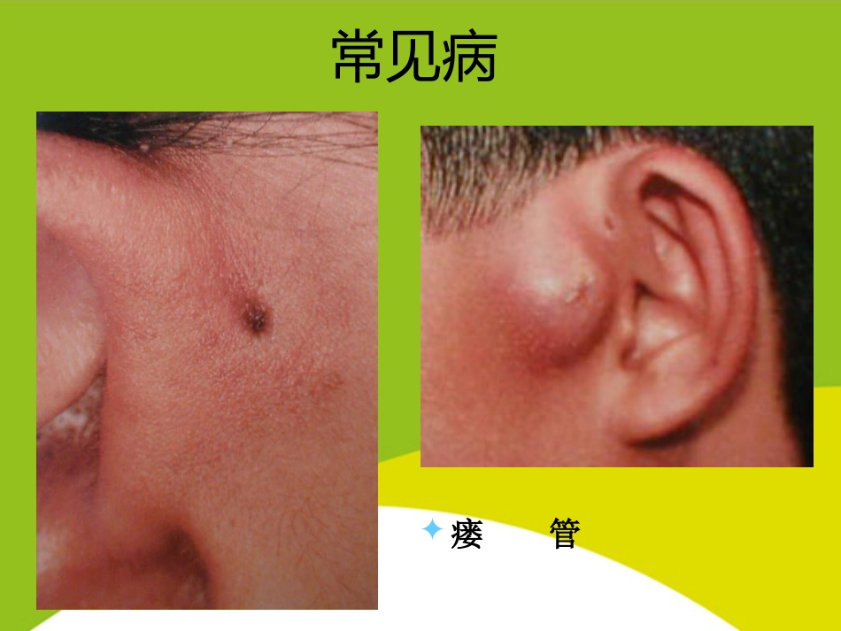 耳的应用解剖与生理PPT_第8页