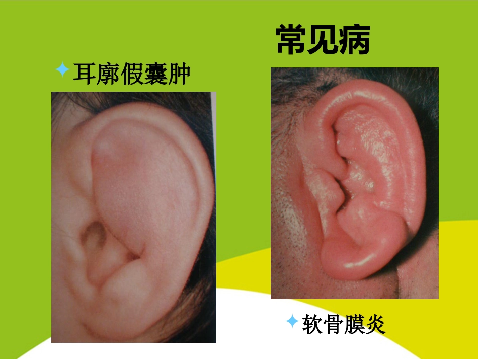 耳的应用解剖与生理PPT_第9页