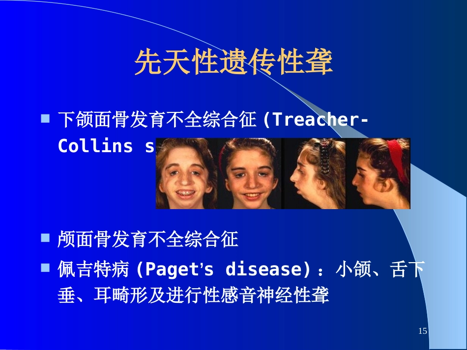 耳鼻咽喉-头颈外科聋及其防治_第15页