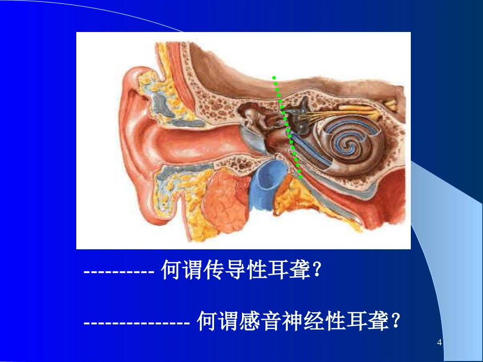 耳鼻咽喉-头颈外科聋及其防治_第4页
