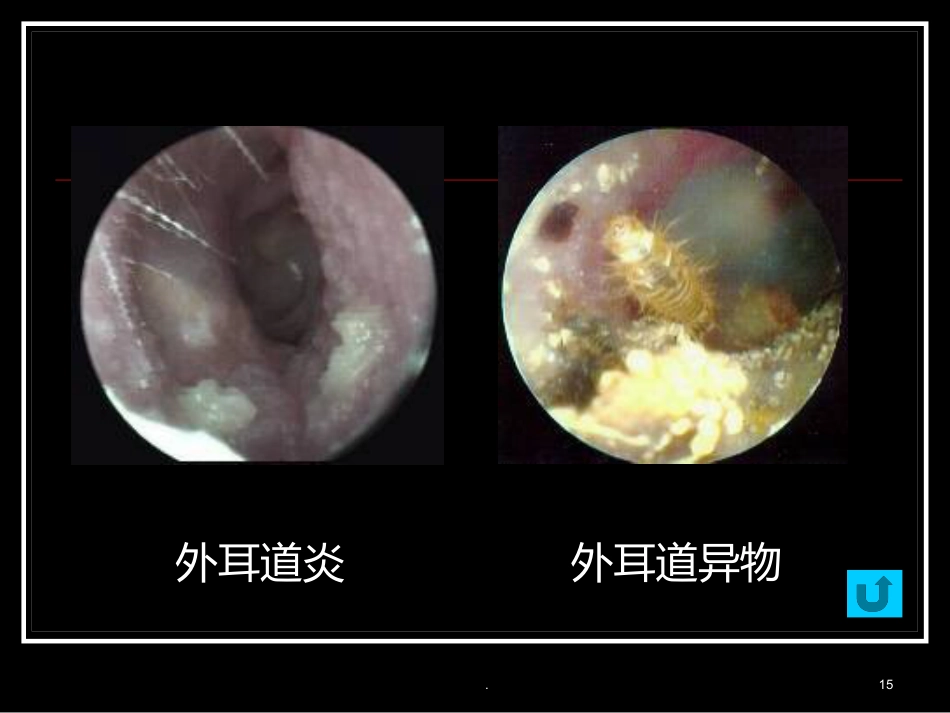耳朵的结构及功能_第15页