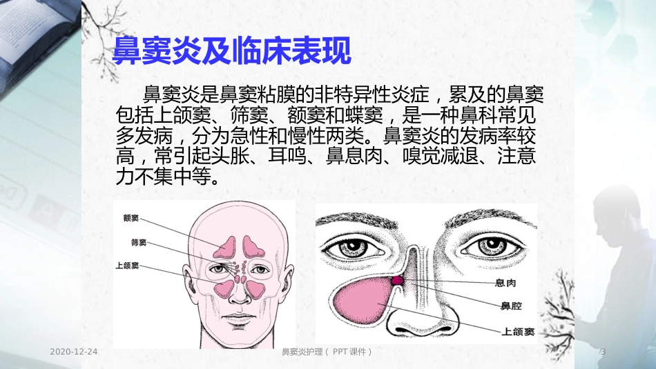 鼻窦炎护理(PPT课件)_第3页