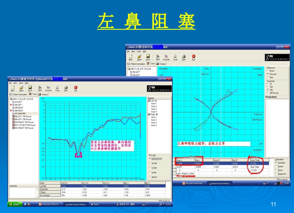 鼻功能诊断系统图谱课件_第11页