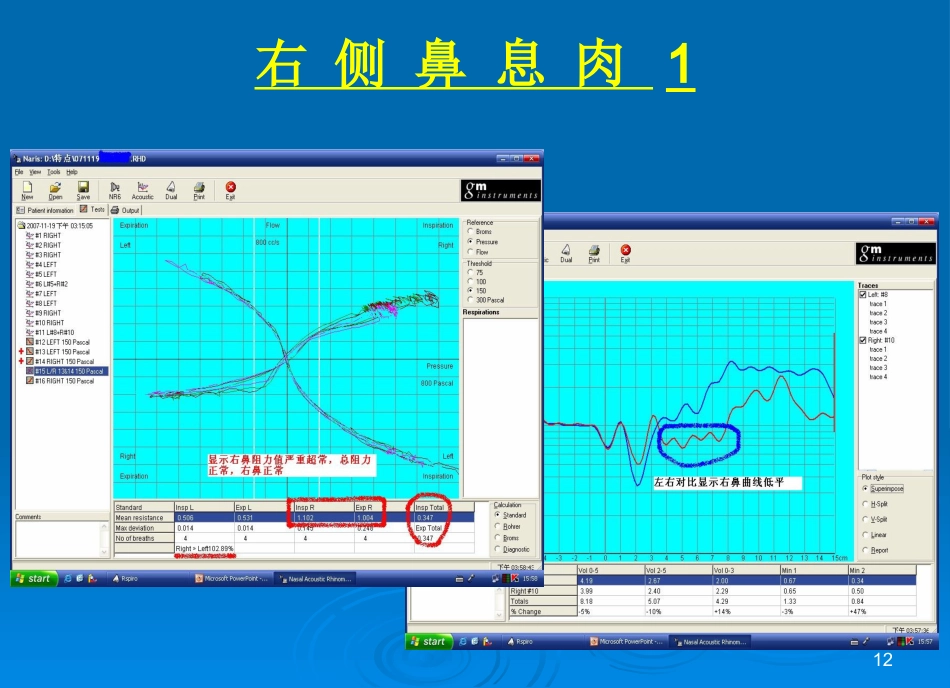 鼻功能诊断系统图谱课件_第12页