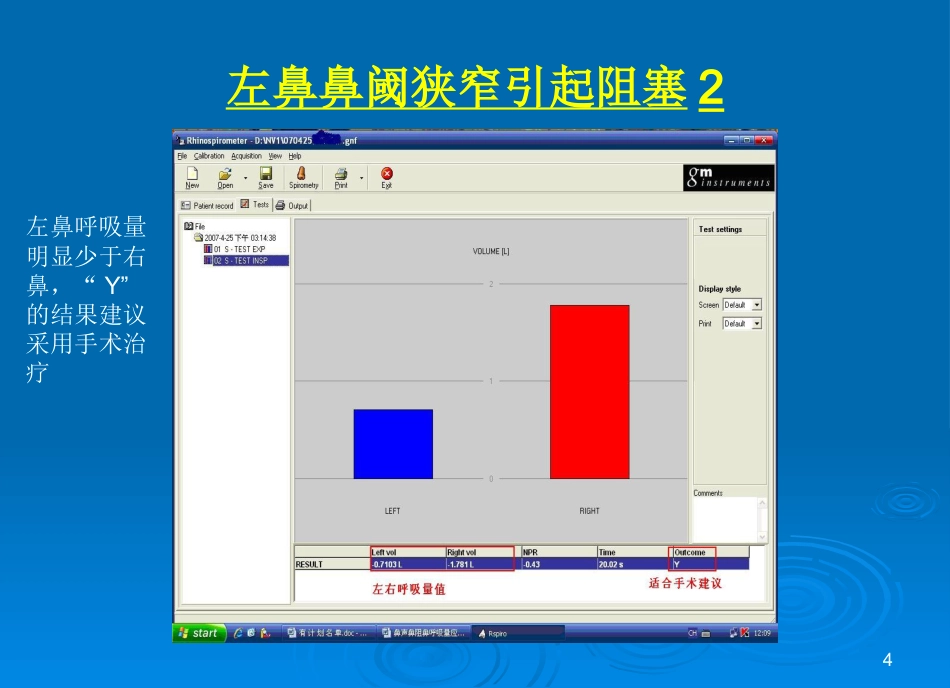 鼻功能诊断系统图谱课件_第4页