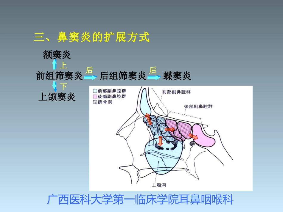 鼻窦炎_第3页