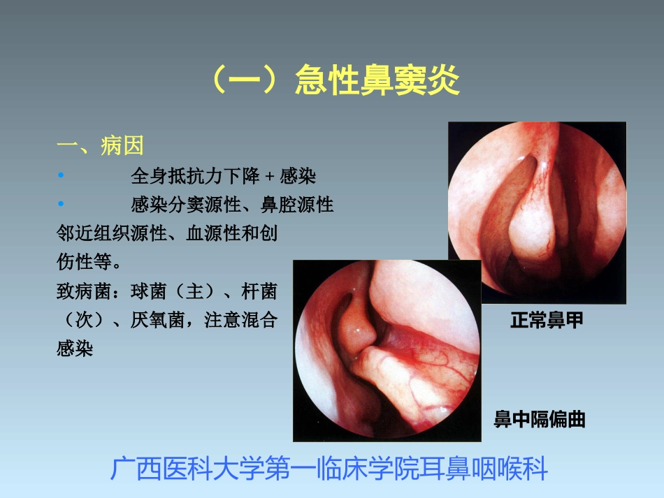 鼻窦炎_第5页