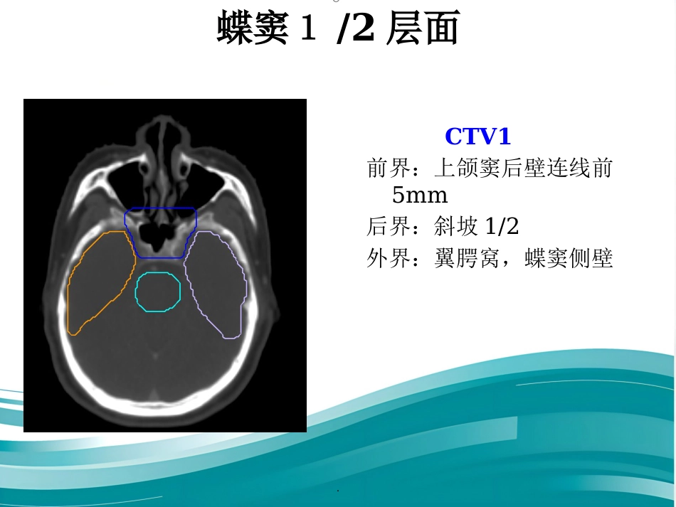 鼻咽癌靶区勾画修订版_第14页