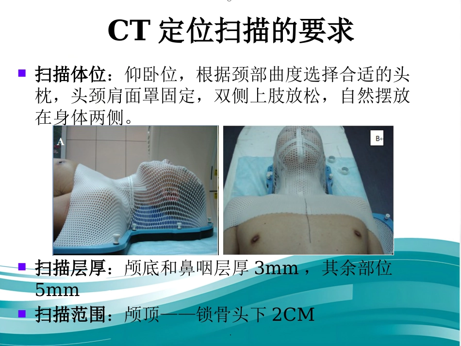 鼻咽癌靶区勾画修订版_第4页