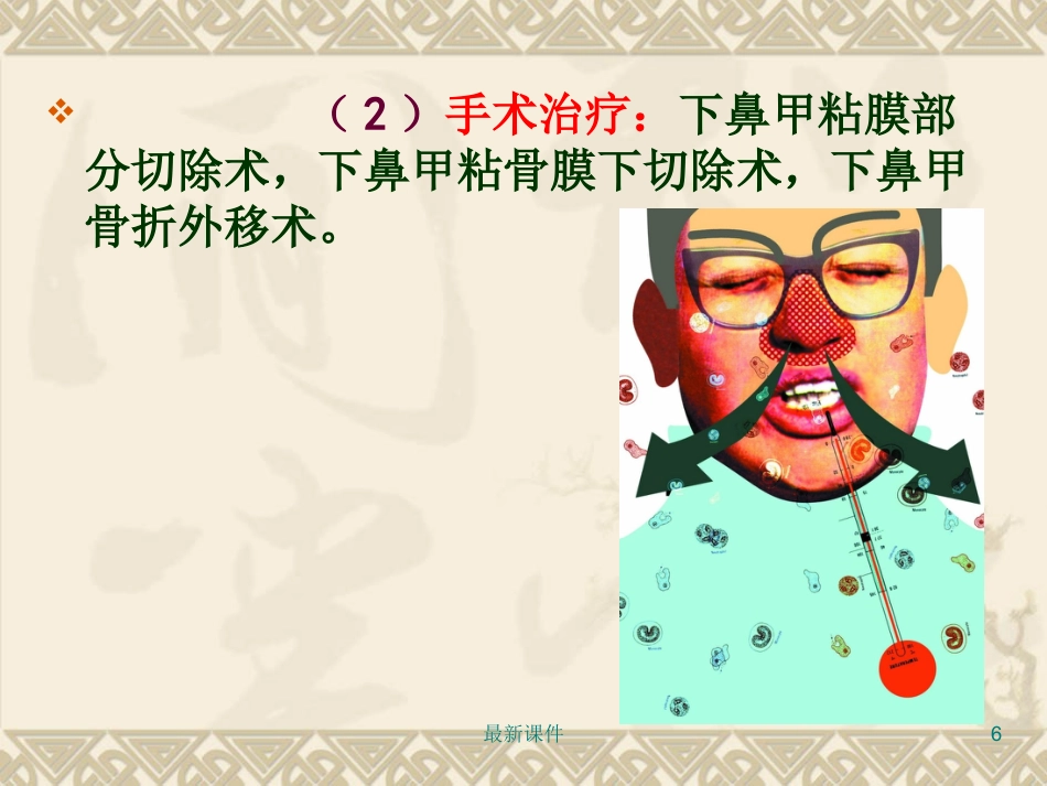 鼻炎鼻窦炎PPT课件_第6页
