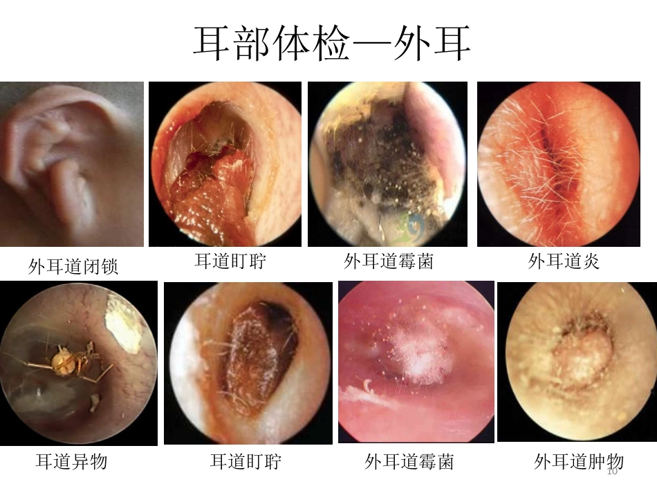 耳鼻喉科一般检查PPT课件_第10页