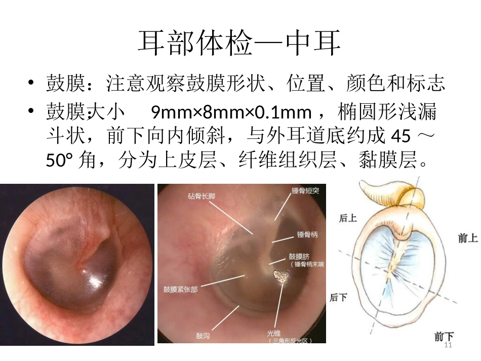 耳鼻喉科一般检查PPT课件_第11页