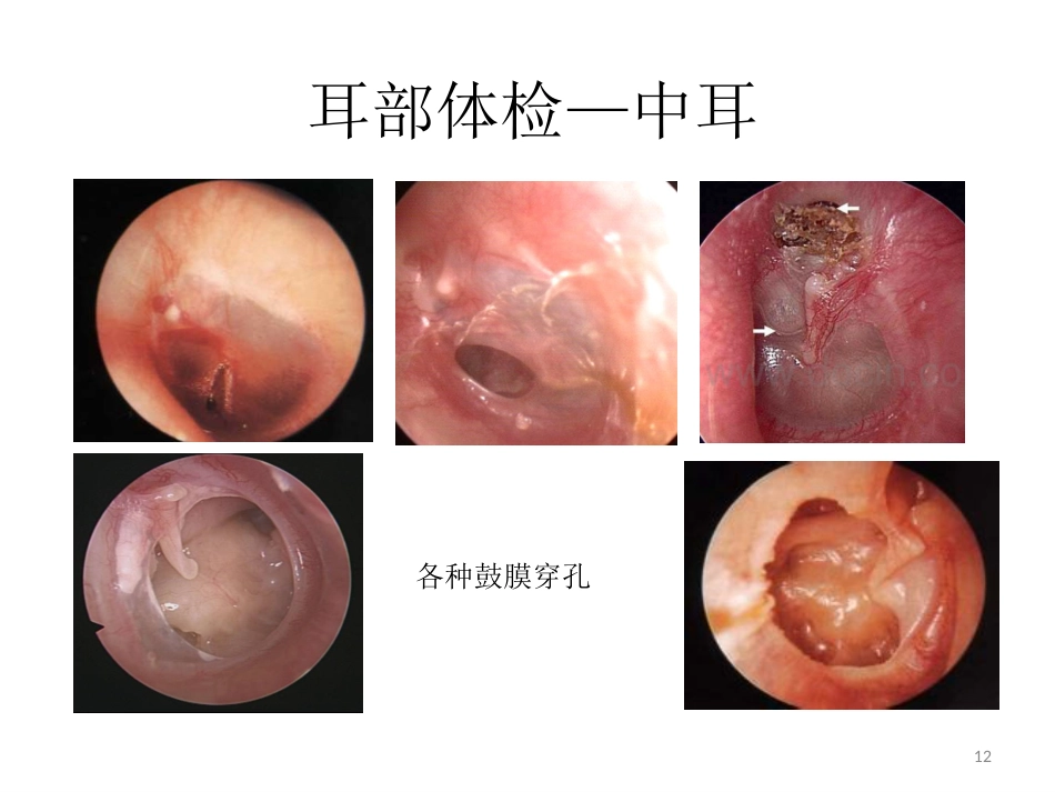 耳鼻喉科一般检查PPT课件_第12页