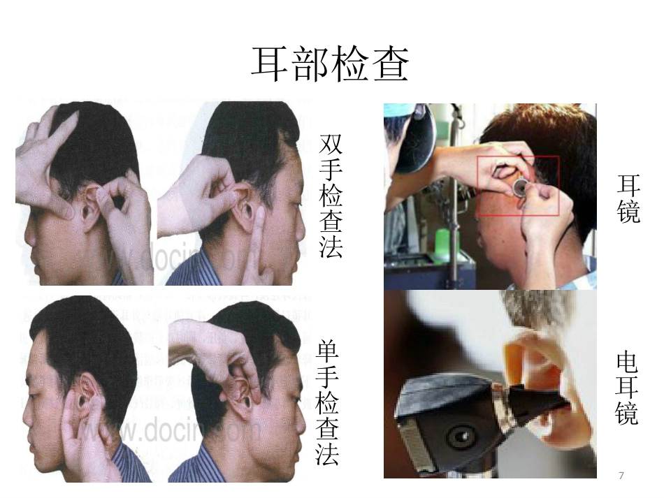 耳鼻喉科一般检查PPT课件_第7页