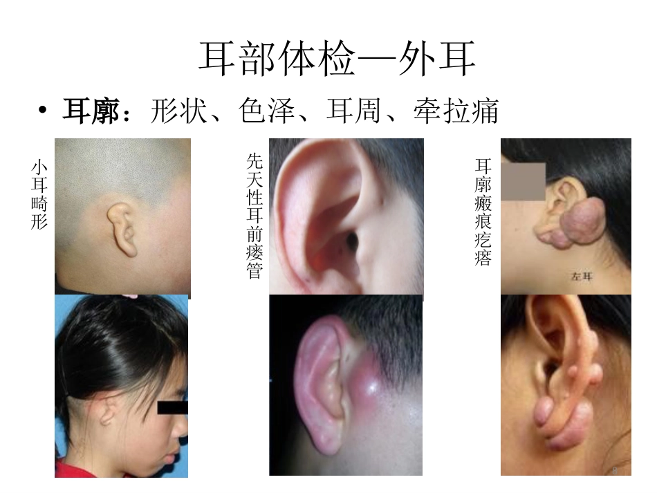 耳鼻喉科一般检查PPT课件_第8页