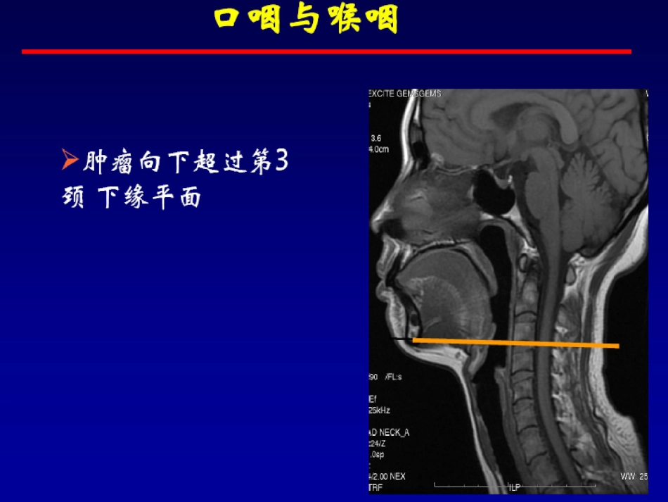 鼻咽癌的放射治疗课件_第11页