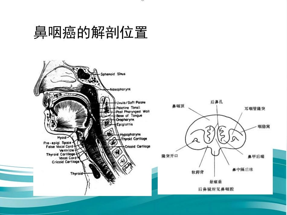鼻咽癌的放射治疗课件_第5页