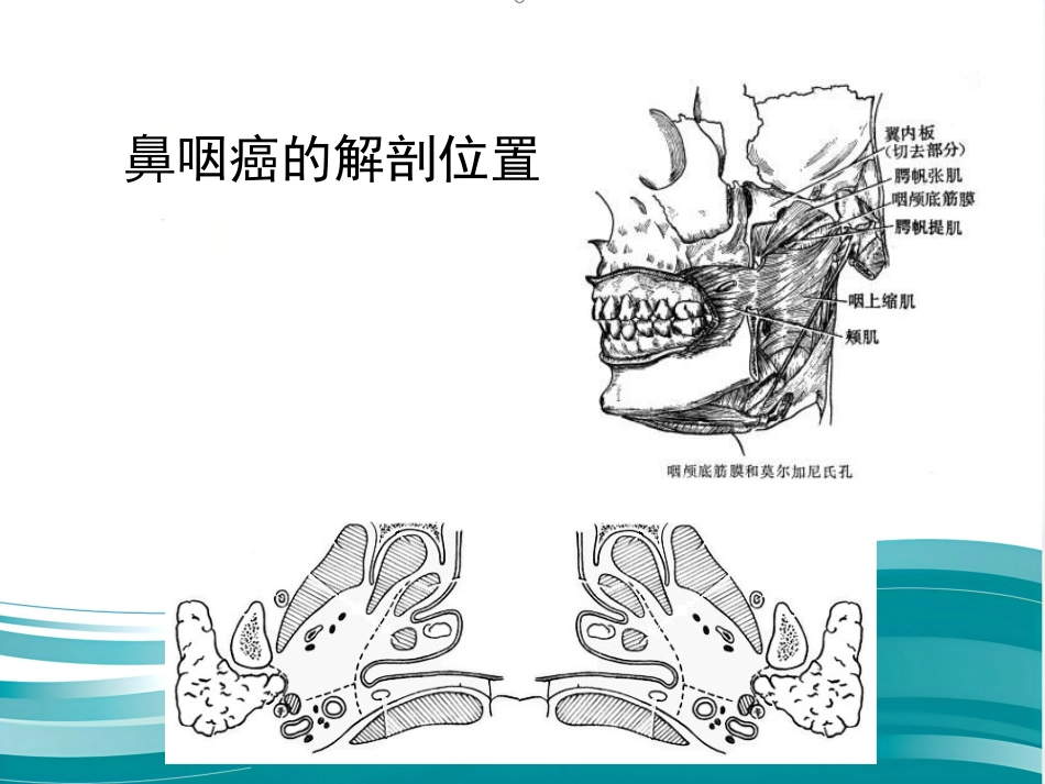 鼻咽癌的放射治疗课件_第6页