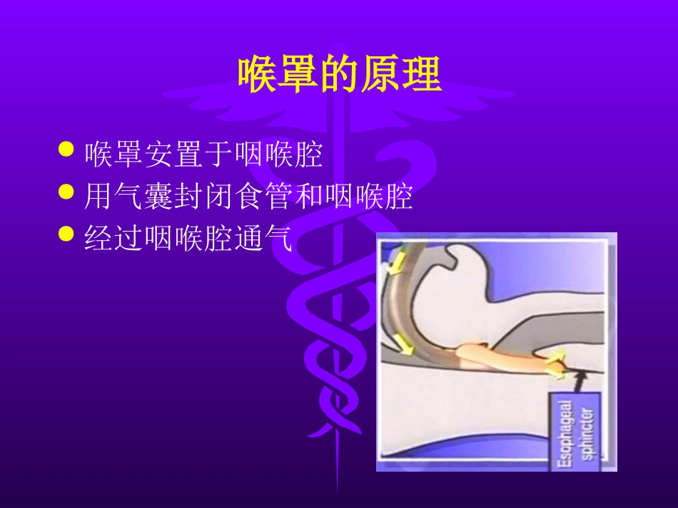 喉罩的临床应用_第14页