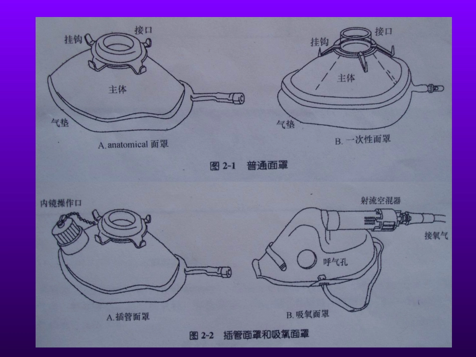 喉罩的临床应用_第7页