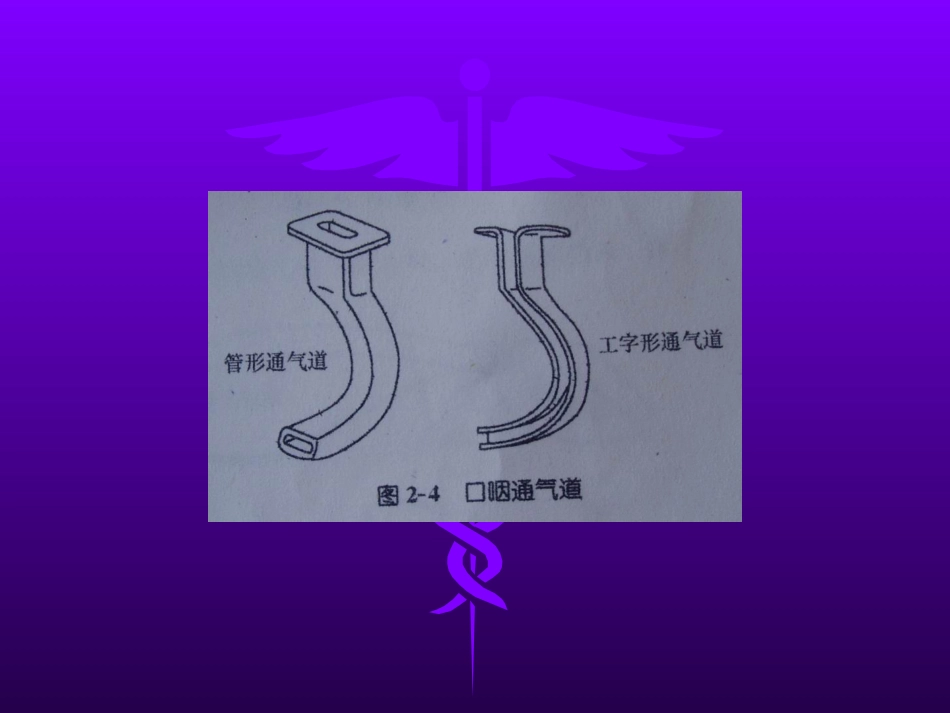 喉罩的临床应用_第8页