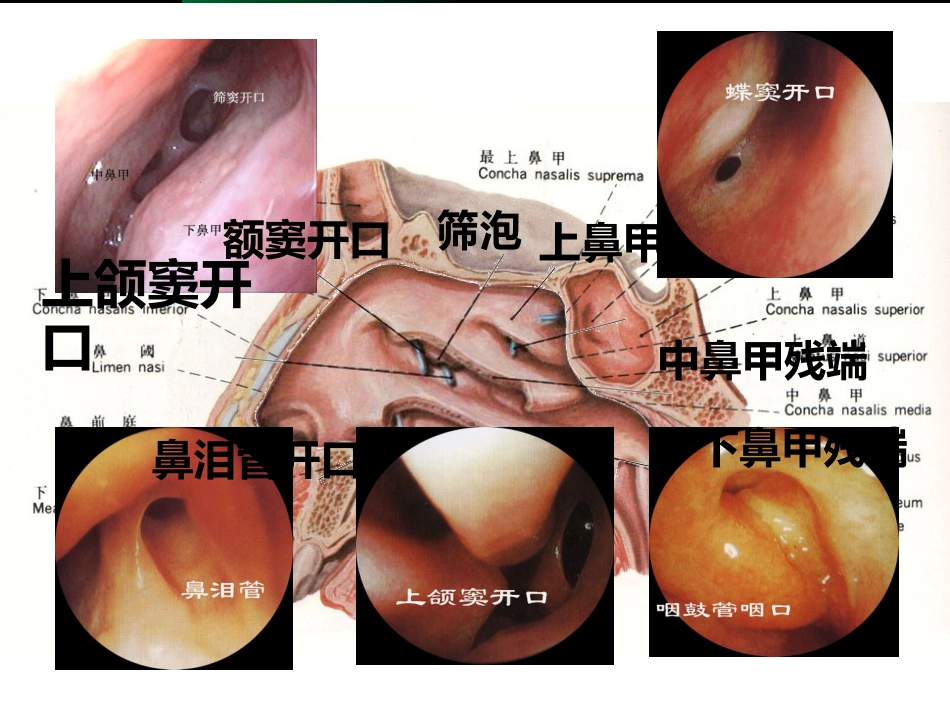 鼻渊_第9页