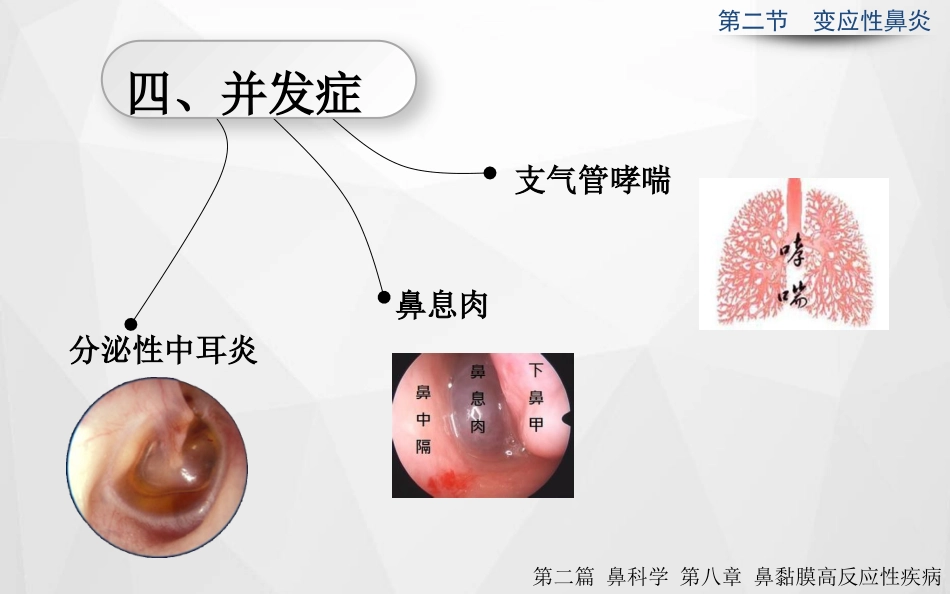 变应性鼻炎正式_第9页
