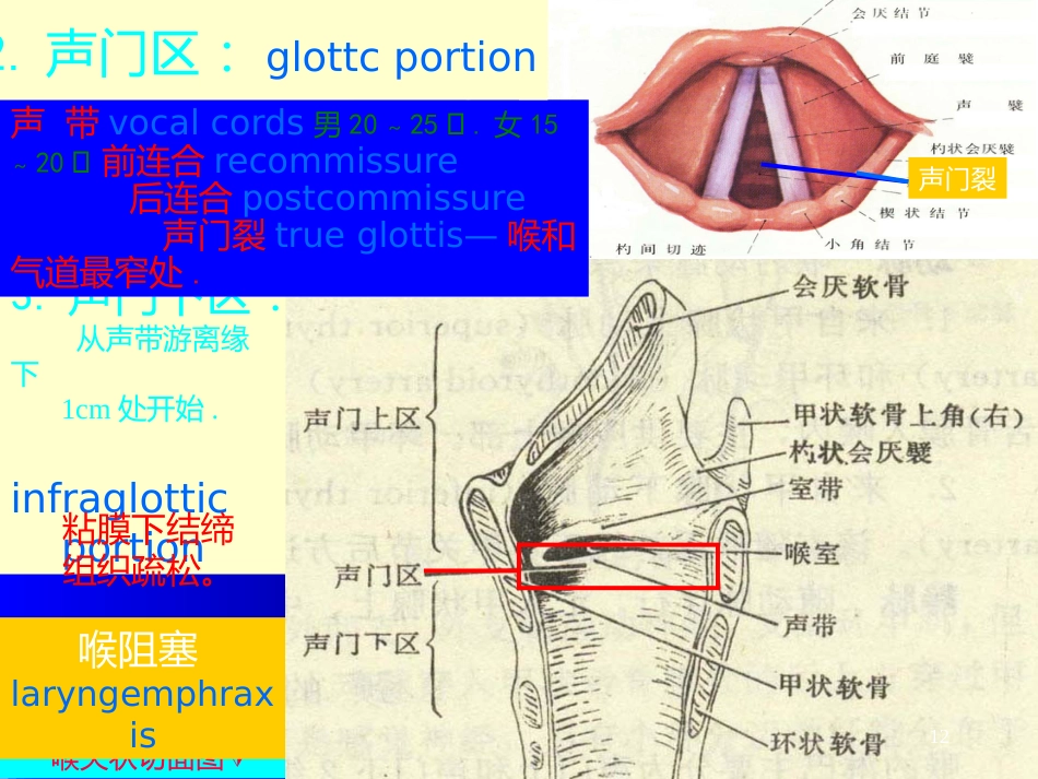 喉解剖急性会厌炎急慢性喉炎ppt课件_第12页