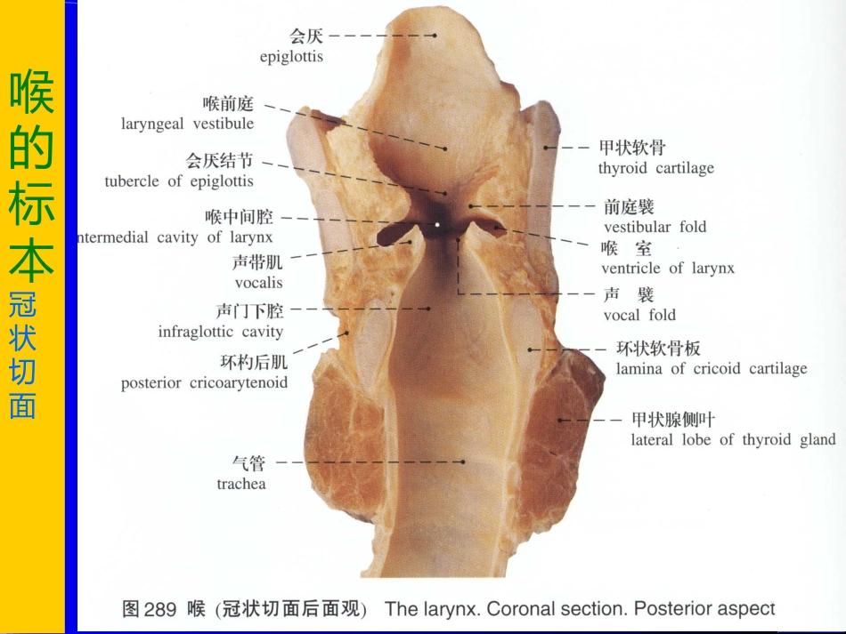 喉解剖急性会厌炎急慢性喉炎ppt课件_第15页