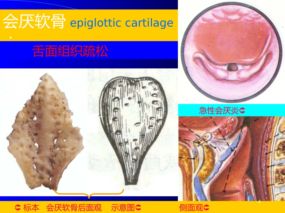 喉解剖急性会厌炎急慢性喉炎ppt课件_第4页