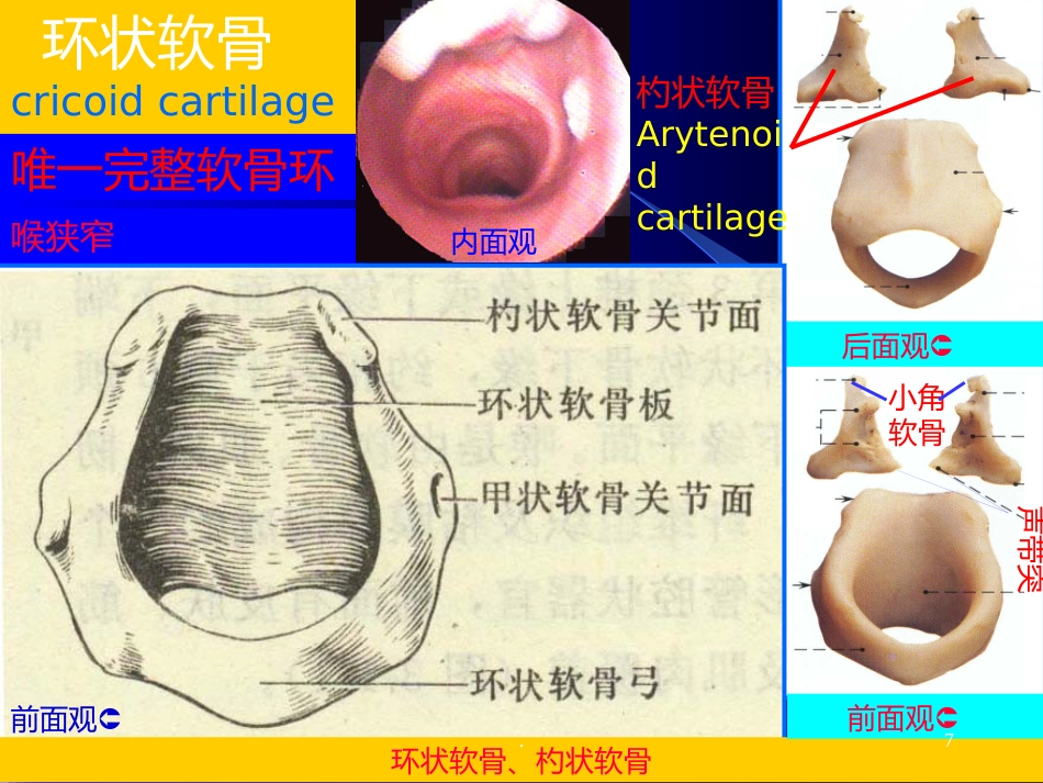 喉解剖急性会厌炎急慢性喉炎ppt课件_第7页