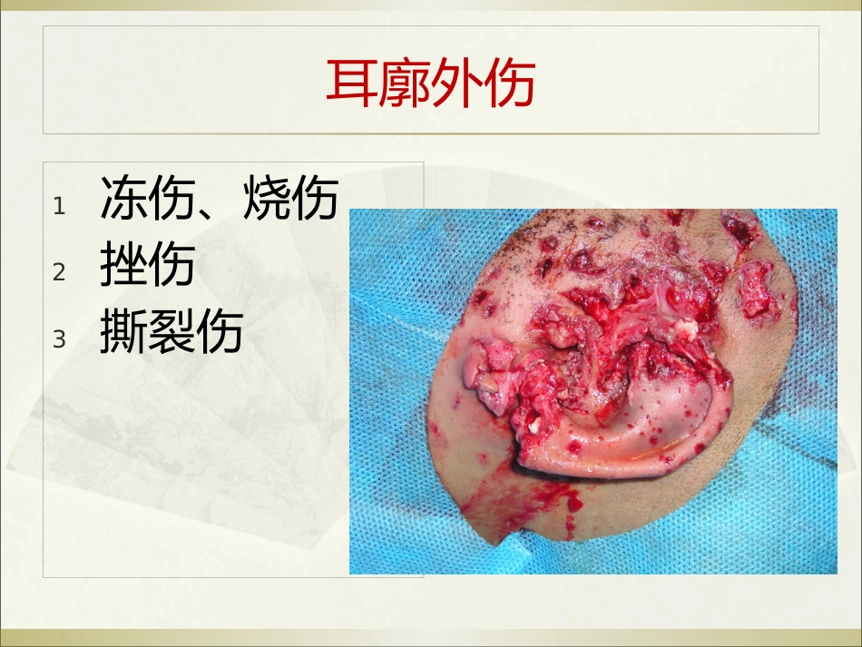耳科常见疾病_第11页