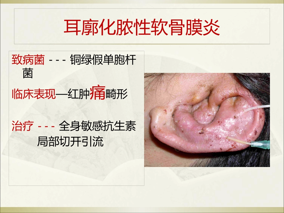 耳科常见疾病_第12页