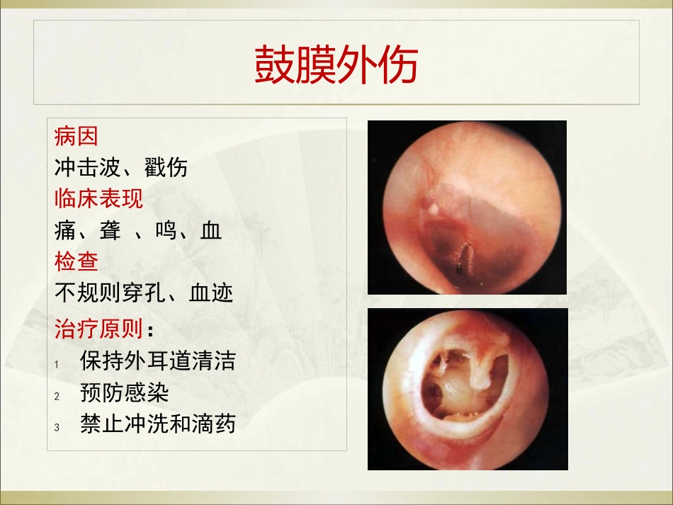 耳科常见疾病_第13页