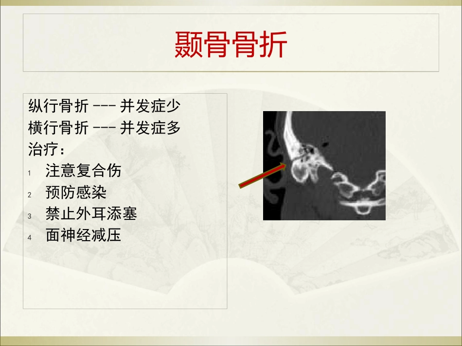 耳科常见疾病_第14页