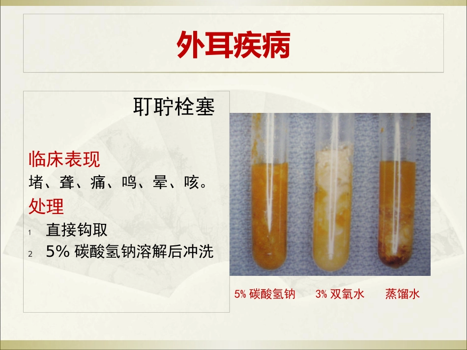 耳科常见疾病_第15页