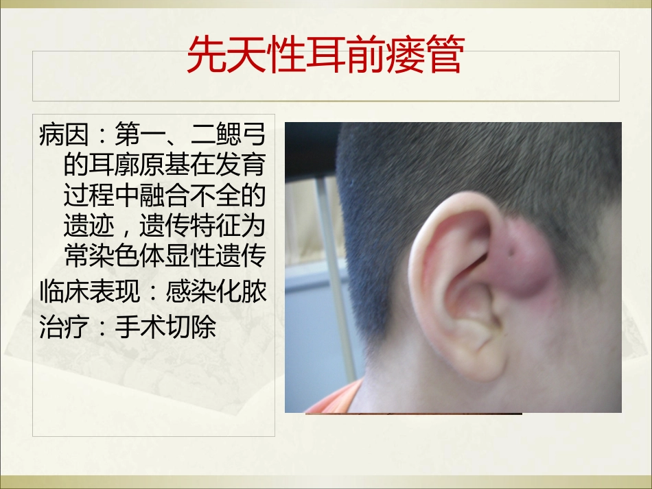 耳科常见疾病_第7页