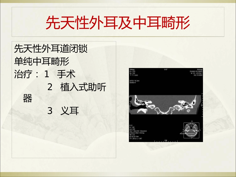 耳科常见疾病_第8页