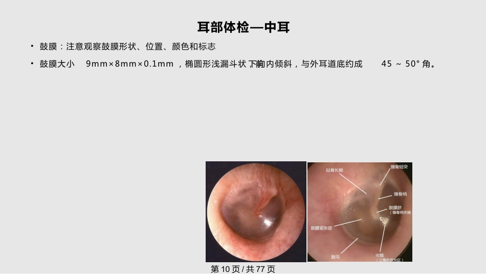 耳鼻喉科体检PPT课件_第10页