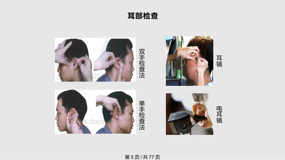 耳鼻喉科体检PPT课件_第5页